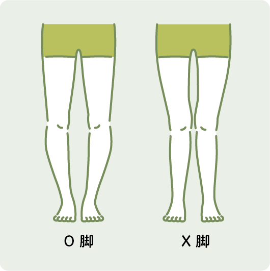 O脚とX脚の比較表
